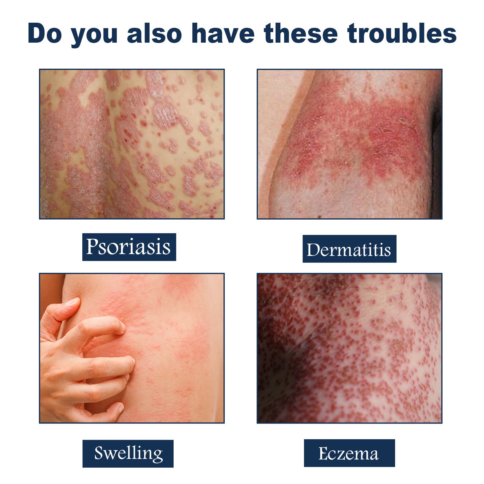 Body Care Spray Relieves