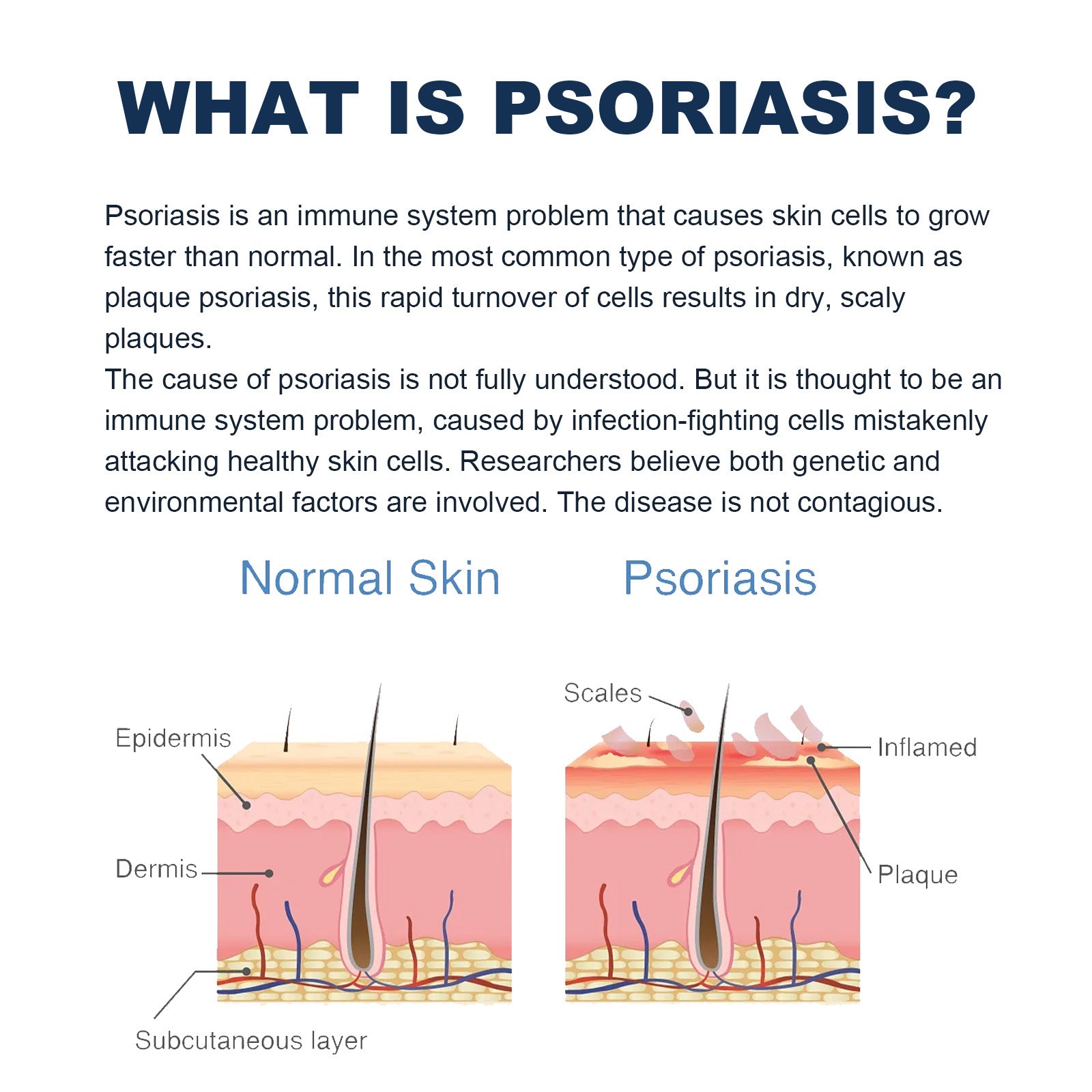 Body Care Spray Relieves